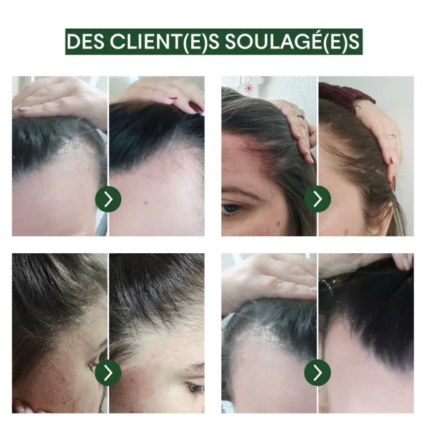 page_produit_concentre_anti-pso_6_f7319f33-6841-4466-afbf-e365ee12dcd4_1200x1200.png