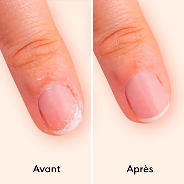 Before_after.jpg